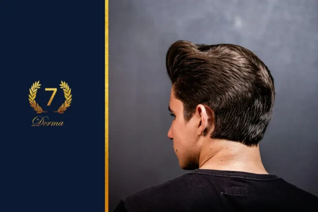 prp for hair loss in dubai
