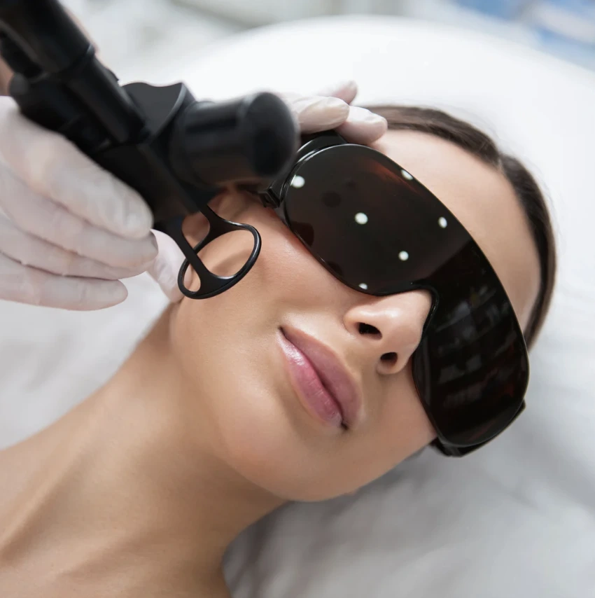pico laser treatment in Dubai by 7 Derma